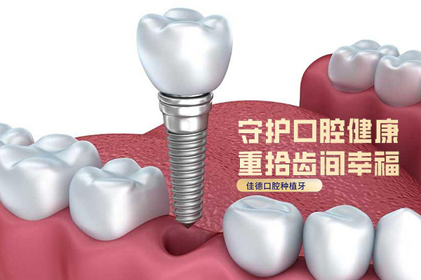 合肥种植牙哪家好